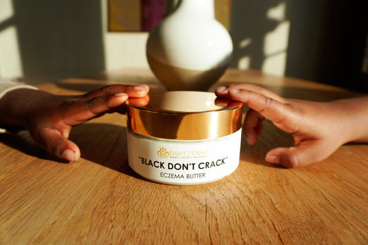 "Black Don’t Crack" Eczema Butter